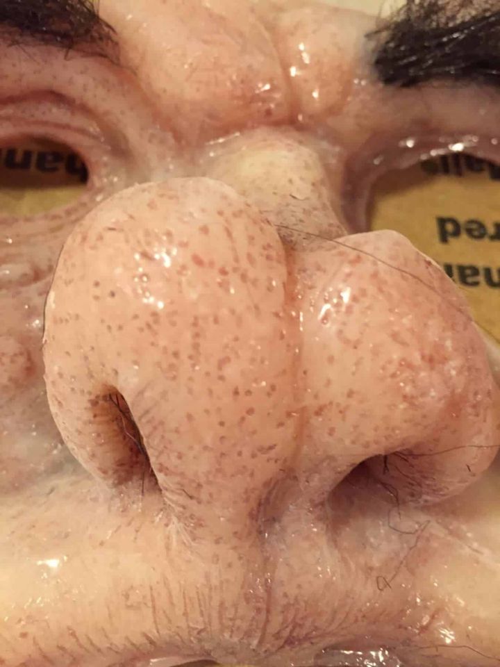 Macro view of skin pores painted on the Evazan appliance